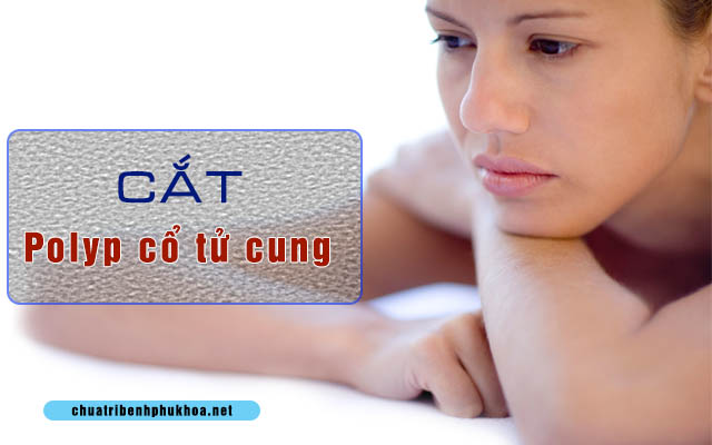 Cắt Polyp cổ tử cung có nguy hiểm không?