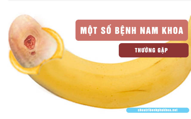 Một số bệnh nam khoa thường gặp