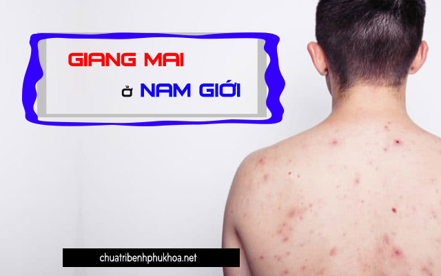 Bệnh giang mai ở nam giới