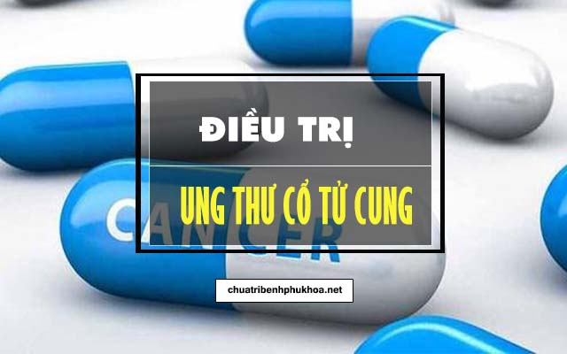 Cách điều trị ung thư cổ tử cung giai đoạn đoạn 1