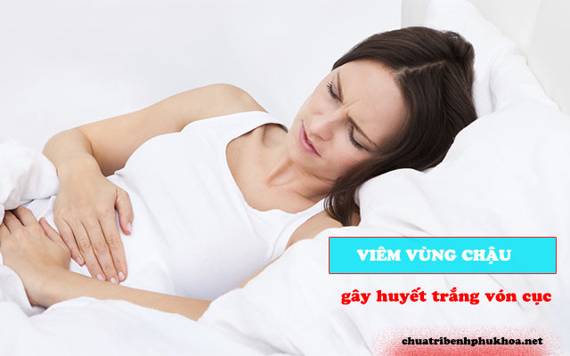 Huyết trắng vón cục do viêm vùng chậu