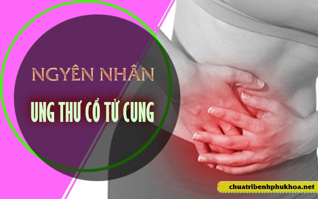 nguyên nhân ung thư cổ tử cung