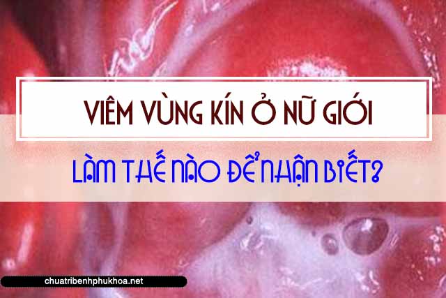 Triệu chứng viêm vùng kín ở nữ giới