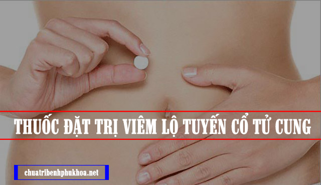 cách đặt thuốc trị viêm lộ tuyến cổ tử cung