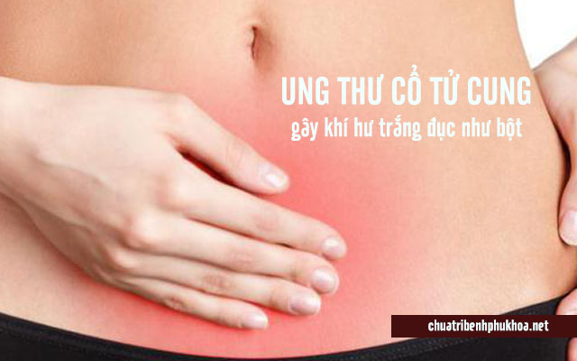 Khí hư trắng đục như bột báo hiệu ung thư cổ tử cung