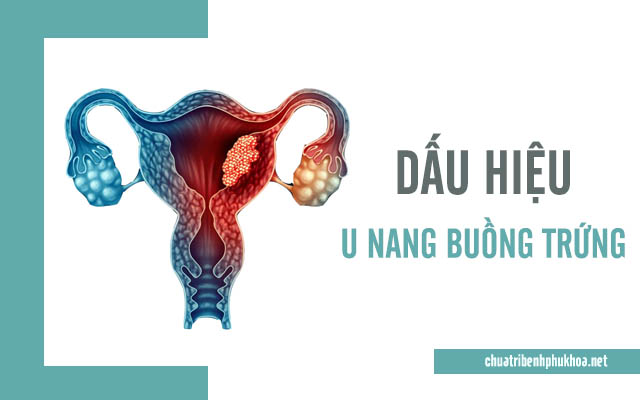 10 dấu hiệu dễ nhân biết nhất của u nang buồng trứng