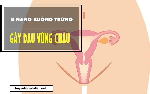 bị đau vùng xương chậu do u nang buồng trứng