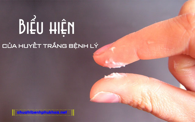 Biểu hiện của huyết trắng bệnh lý 