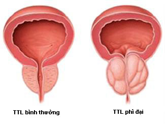 cac-benh-nam-khoa-thuong-gap-o-nam-gioi2