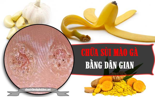 Chữa sùi mào gà bằng phương pháp dân gian