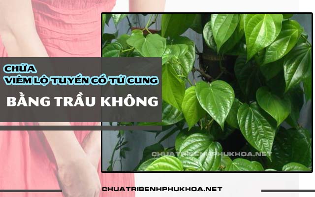 trầu không điều trị viêm lộ tuyến cổ tử cung 