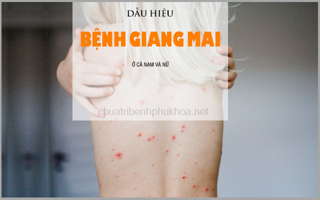 dấu hiệu bệnh giang mai