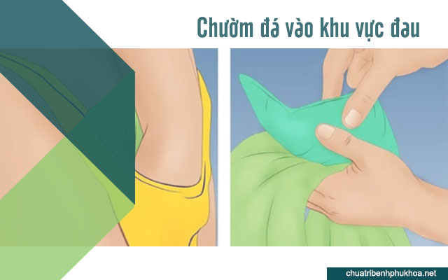 Bạn có thể chườm một túi đá để giảm đau sau khi quan hệ