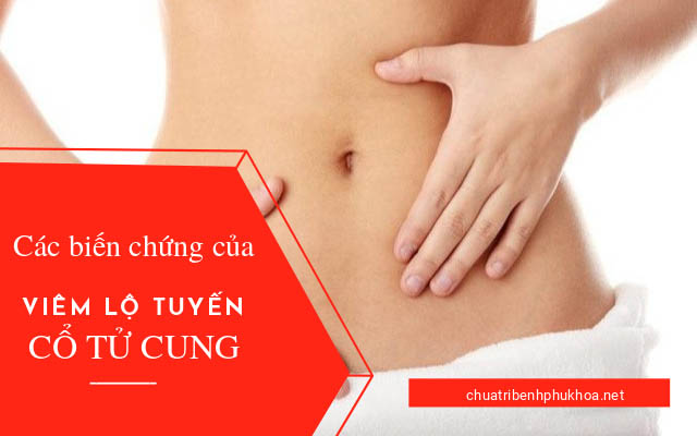 bệnh viêm lộ tuyến cổ tử cung có nguy hiểm