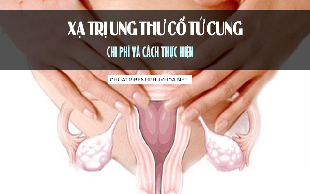 xạ trị ung thư cổ tử cung