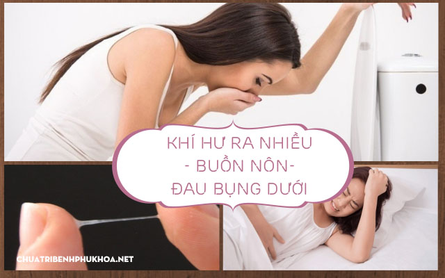 Ra nhiều khí hư kèm cảm giác buồn nôn và đau bụng dưới