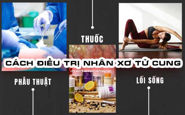 Cách điều trị nhân xơ tử cung