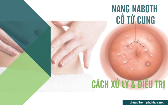 Cách xử lý và điều trị nang naboth ở cổ tử cung