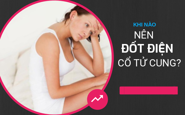 khi nào nên đốt điện cổ tử cung