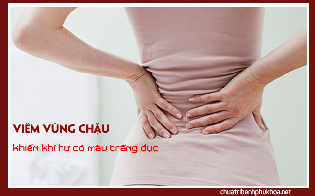 Viêm vùng chậu gây ra nhiều khí hư có màu trắng đục không mùi