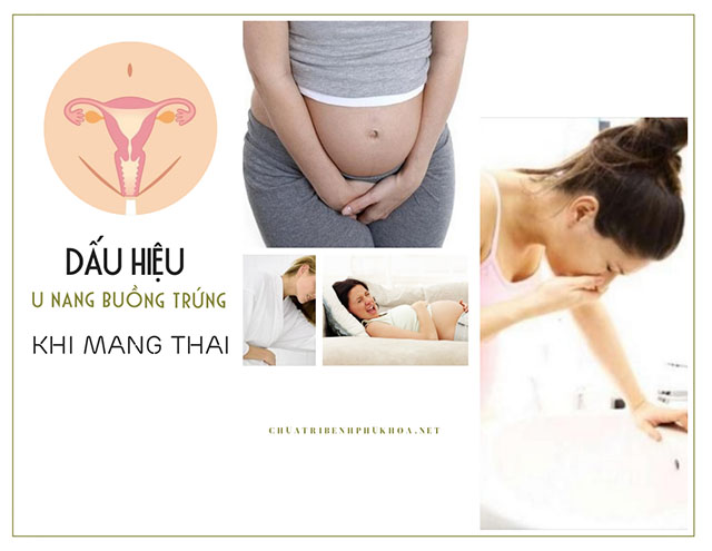 u nang buồng trứng trái khi mang thai