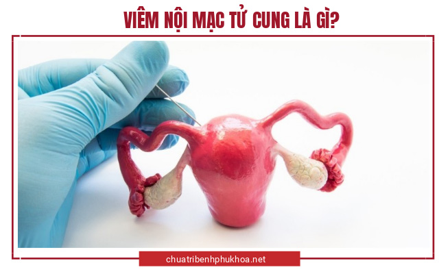 viêm nội mạc tử cung là bệnh gì