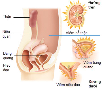 dau-hieu-viem-duong-tiet-nieu-o-nam-va-nu