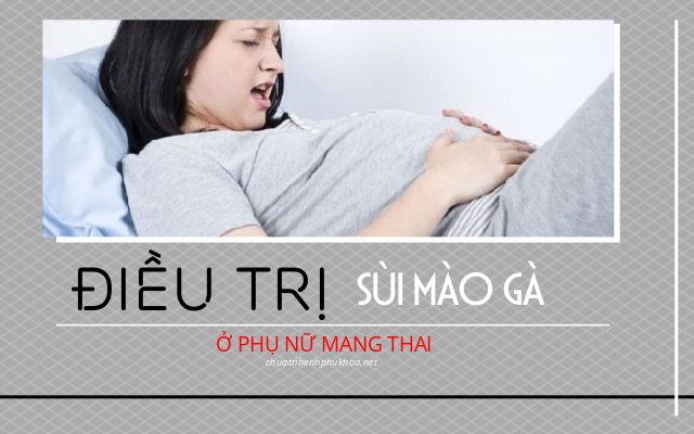 chữa bệnh sùi mào gà ở phụ nữ mang thai