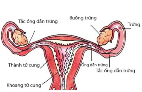 cach-dieu-tri-tac-voi-trung-o-nu-gioi-hieu-qua