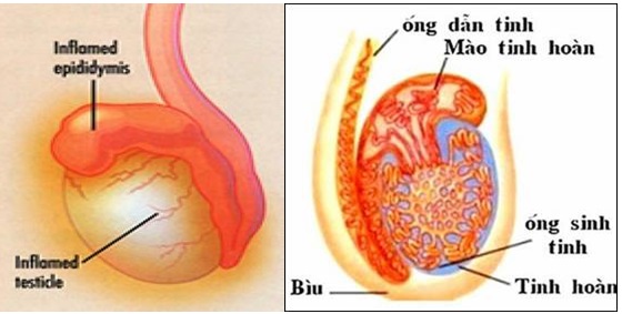 dieu-tri-benh-viem-mao-tinh-hoan-hieu-qua