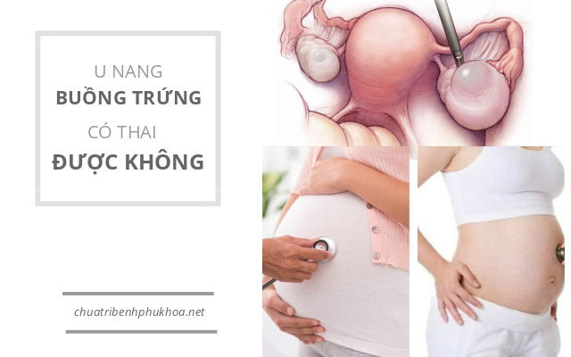 u nang buồng trứng mang thai được không