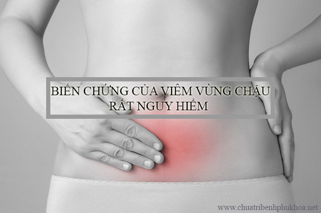 Bệnh viêm vùng chậu là gì