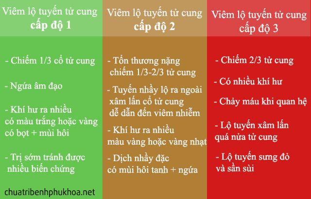 Dấu hiệu viêm lộ tuyến cổ tử cung qua từng cấp độ