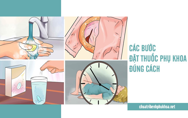 hướng dẫn đặt thuốc phụ khoa 