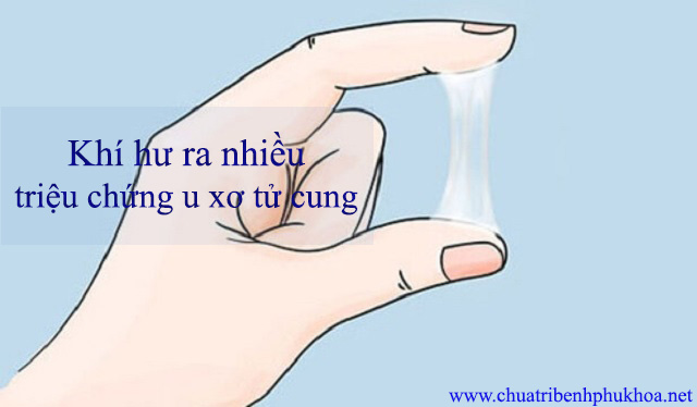 Ra nhiều khí hư là dấu hiệu bệnh u xơ cổ tử cung