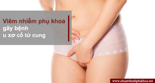 Viêm nhiễm phụ khoa là nguyên nhân gây bệnh u xơ cổ tử cung