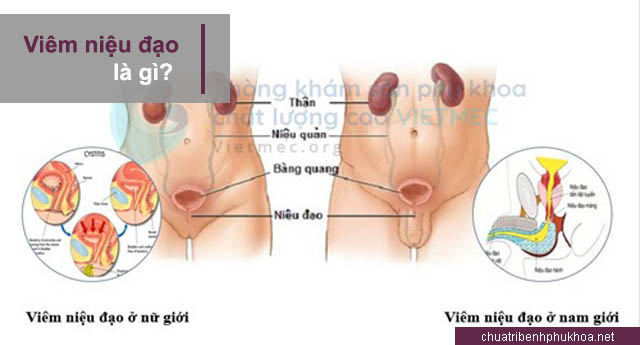 nguyên nhân viêm niệu đạo ở nam giới và phụ nữ