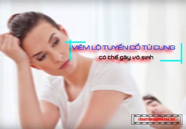 Viêm lộ tuyến cổ tử cung có thể gây vô sinh 