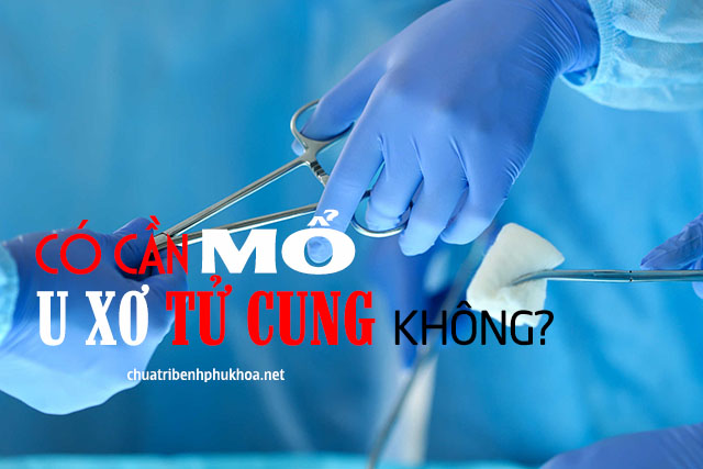  phải mổ u xơ tử cung hay không