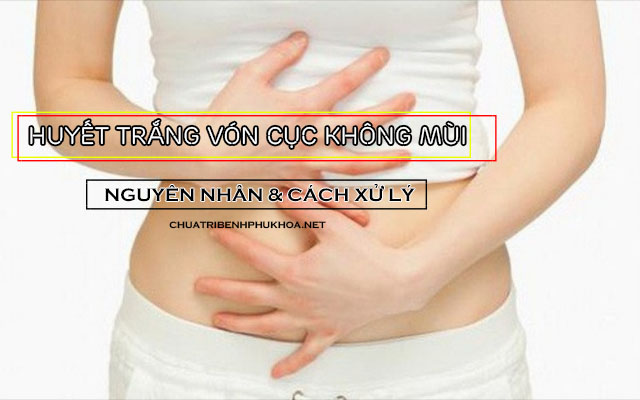 huyết trắng vón cục không mùi