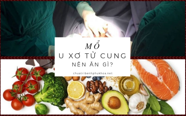 mổ u xơ tử cung nên ăn gì