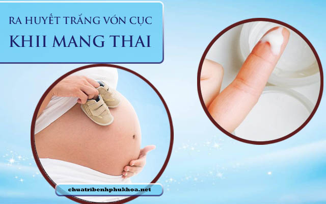  ra huyết trắng vón cục khi mang thai 