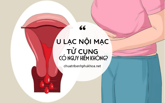 u lạc nội mạc tử cung có nguy hiểm không