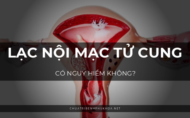 u lạc nội mạc tử cung có nguy hiểm không1