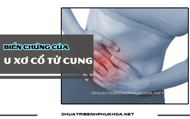 u xơ cổ tử cung có nguy hiểm không3