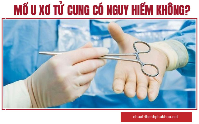 mổ u xơ tử cung có nguy hiểm không