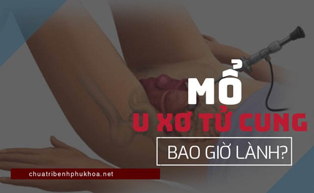 mổ u xơ tử cung bao giờ lành