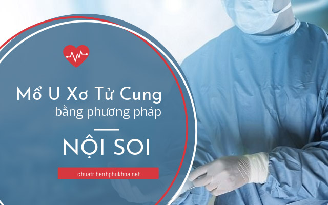 mổ u xơ tử cung bằng phương pháp nội soi