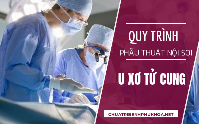 quy trình mổ u xơ tử cung bằng phương pháp nội soi