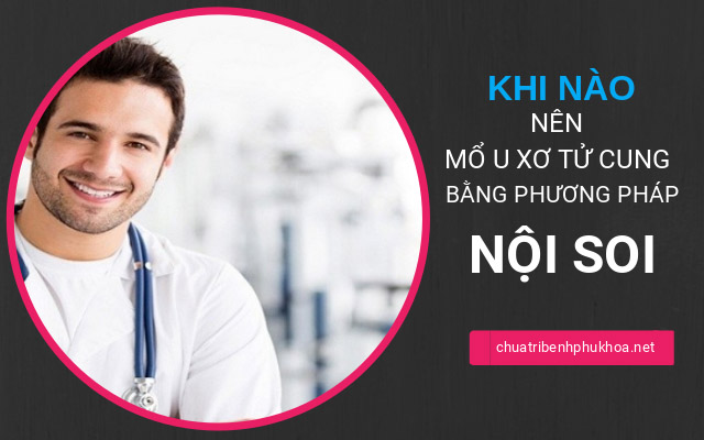 khi nào nên mổ u xơ tử cung bằng phương pháp nội soi